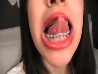 Brunnette big mouth & braces (vore)